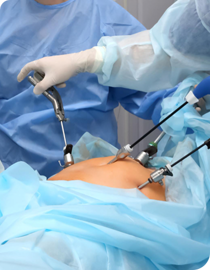 Gastric Bypass